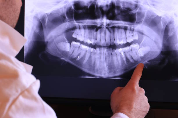 Best Emergency Dentist for Knocked-Out Tooth in New York, NY